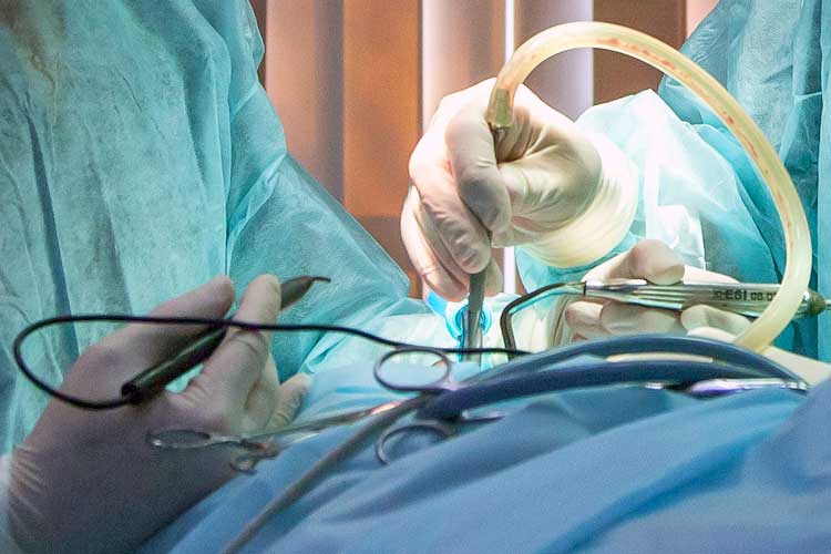 Close up of two surgeons' hands during surgery